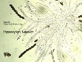 Hypoxylon fuscum-amf996-micro.